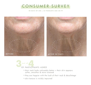 Necks-Level Smooth™ Ultra-Smoothing Triple Effect Neck Cream FHF
