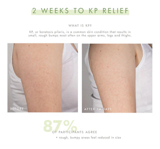 Smooth Reveal™ Resurfacing Silky Serum FHF